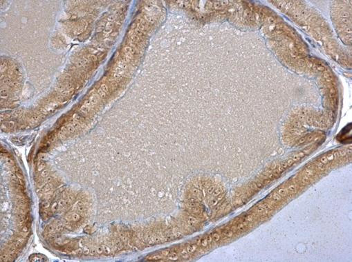 HSC70 Antibody in Immunohistochemistry (Paraffin) (IHC (P))