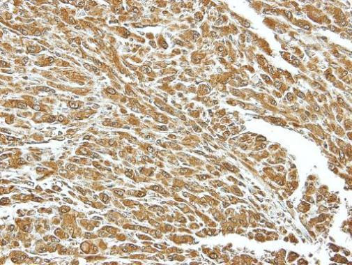 HSC70 Antibody in Immunohistochemistry (Paraffin) (IHC (P))