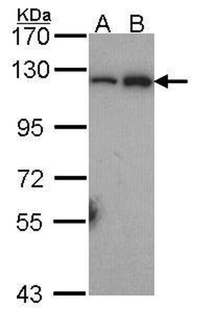NFkB p52 Antibody in Western Blot (WB)