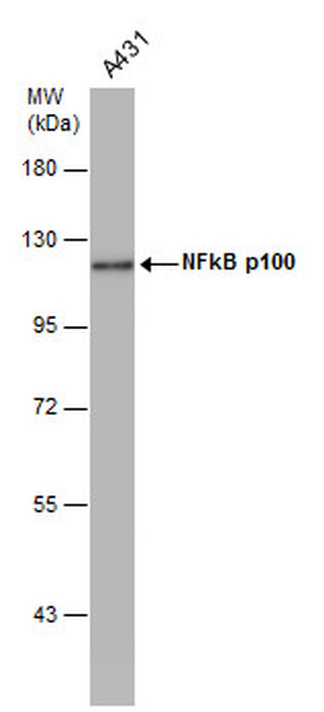 NFkB p52 Antibody in Western Blot (WB)