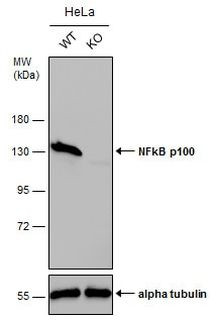 NFkB p52 Antibody