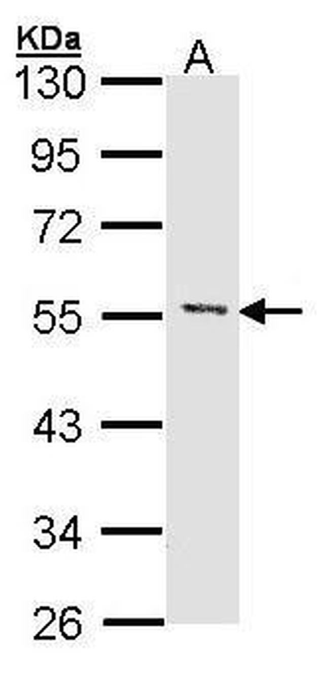 MEF2A Antibody in Western Blot (WB)