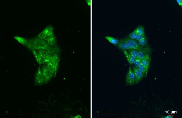 LIPA Antibody in Immunocytochemistry (ICC/IF)