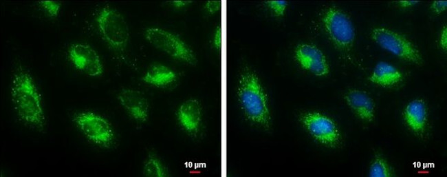 HADHA Antibody in Immunocytochemistry (ICC/IF)