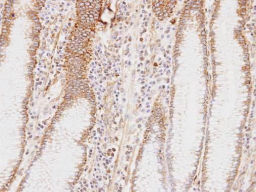 HADHA Antibody in Immunohistochemistry (Paraffin) (IHC (P))