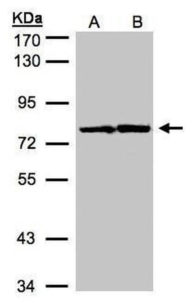 HADHA Antibody in Western Blot (WB)