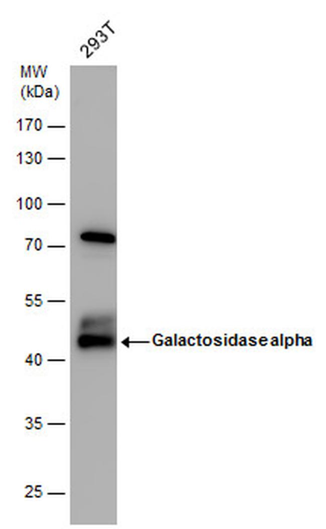 alpha Galactosidase Antibody in Western Blot (WB)