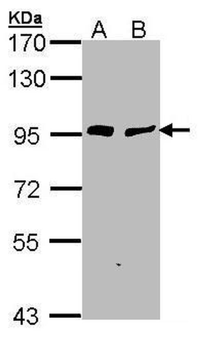 Gelsolin Antibody in Western Blot (WB)