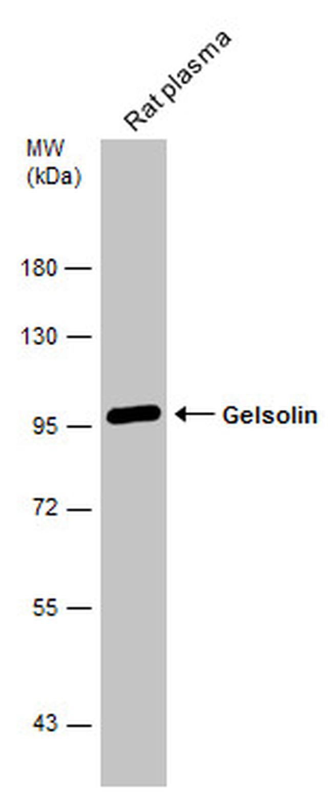 Gelsolin Antibody in Western Blot (WB)