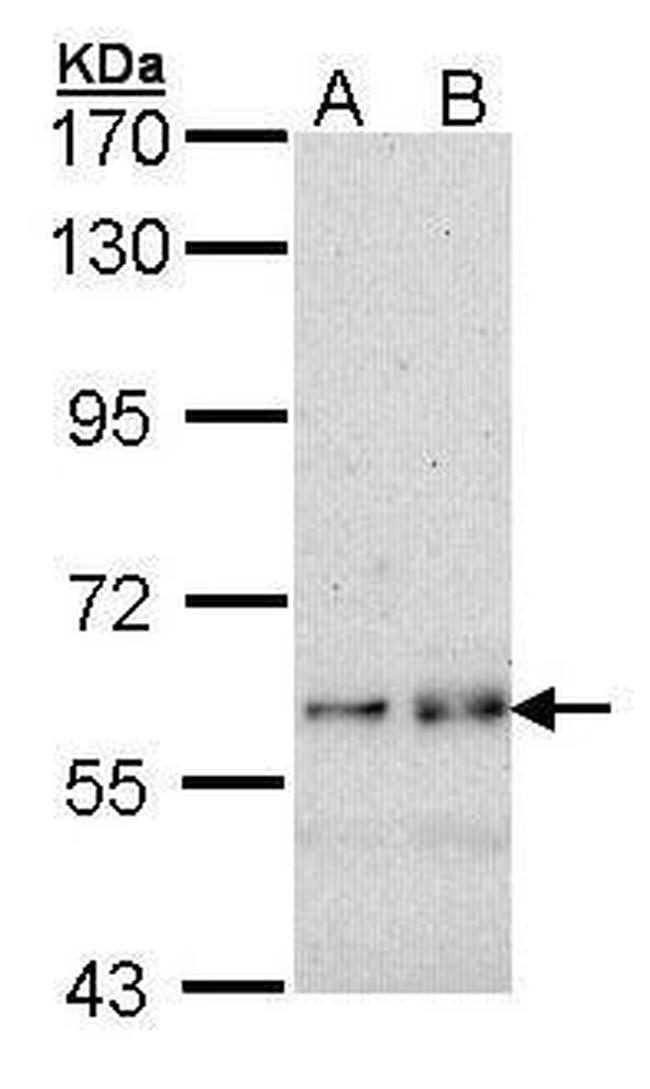 Fyn Antibody in Western Blot (WB)