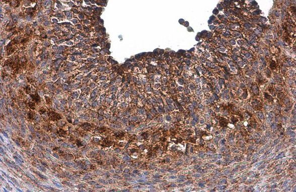 GALC Antibody in Immunohistochemistry (Paraffin) (IHC (P))