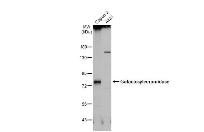 GALC Antibody in Western Blot (WB)