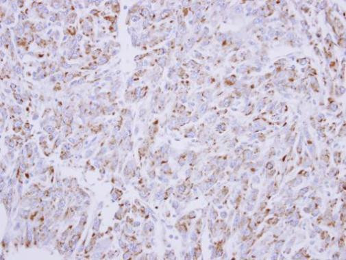 G6PD Antibody in Immunohistochemistry (Paraffin) (IHC (P))