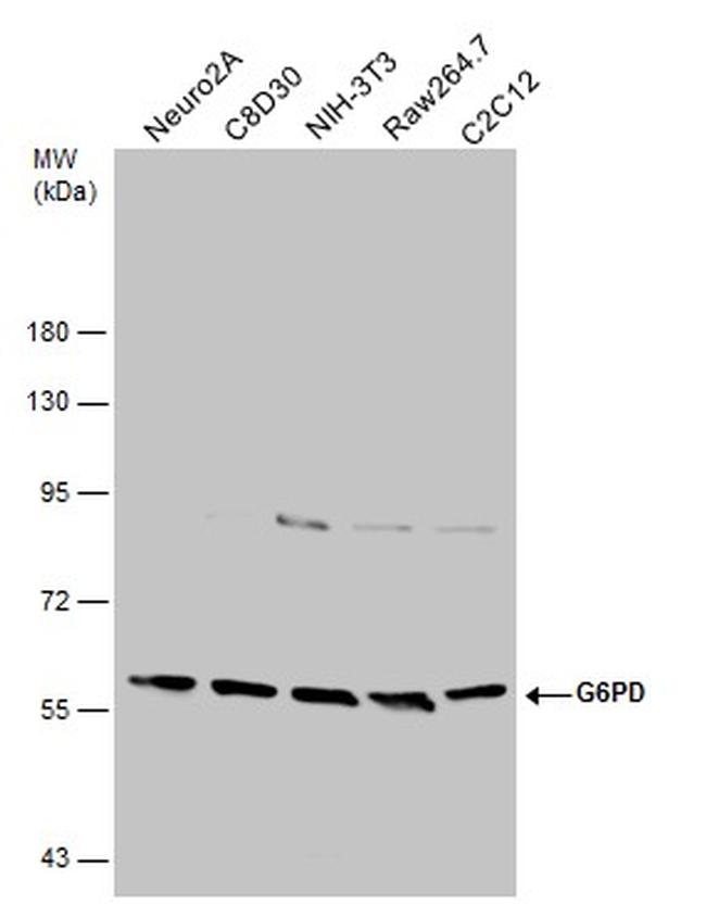 G6PD Antibody in Western Blot (WB)