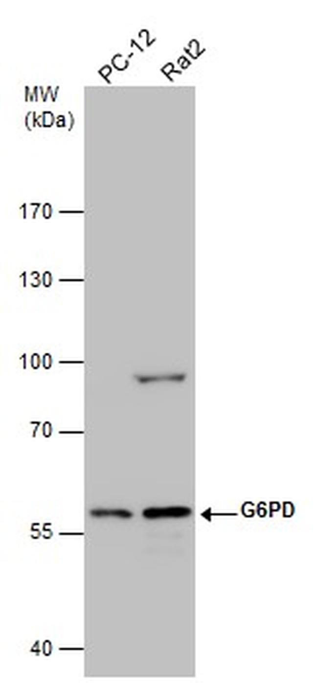 G6PD Antibody in Western Blot (WB)