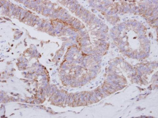 Lyn Antibody in Immunohistochemistry (Paraffin) (IHC (P))