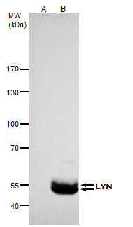 Lyn Antibody in Immunoprecipitation (IP)