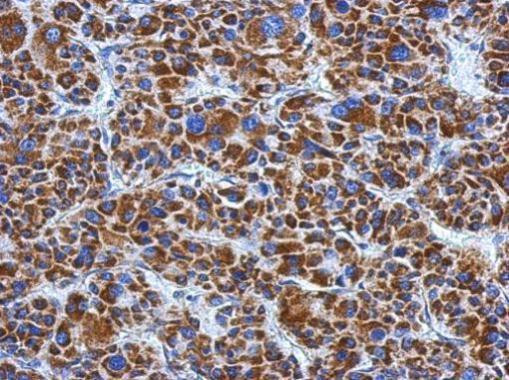 DLD Antibody in Immunohistochemistry (Paraffin) (IHC (P))