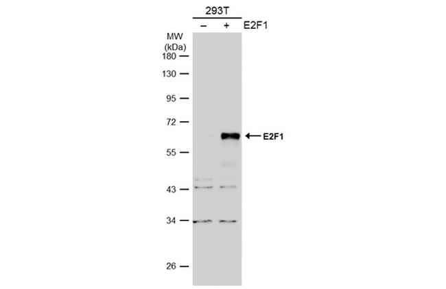 E2F1 Antibody in Western Blot (WB)