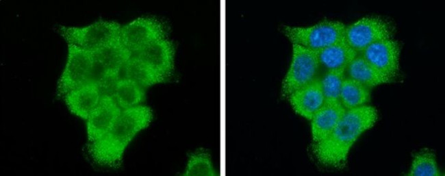 EIF2S1 Antibody in Immunocytochemistry (ICC/IF)