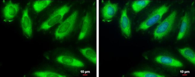 EIF2S1 Antibody in Immunocytochemistry (ICC/IF)