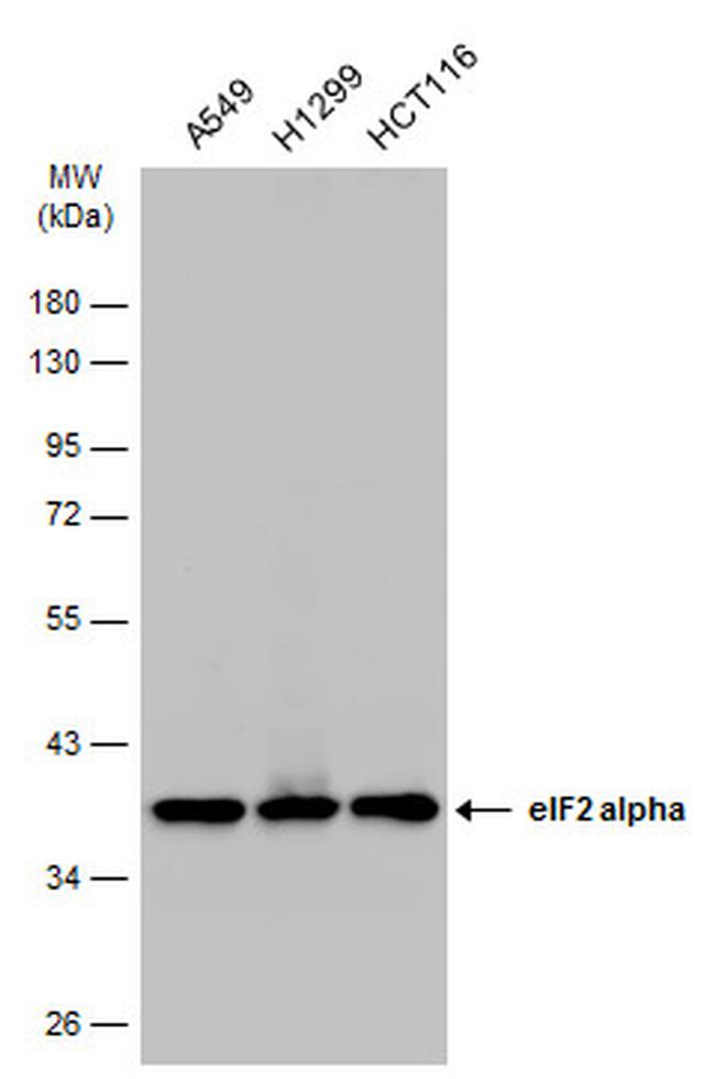 EIF2S1 Antibody in Western Blot (WB)