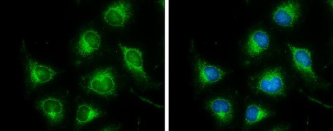 DLD Antibody in Immunocytochemistry (ICC/IF)