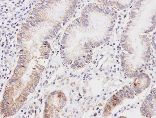 DLD Antibody in Immunohistochemistry (Paraffin) (IHC (P))