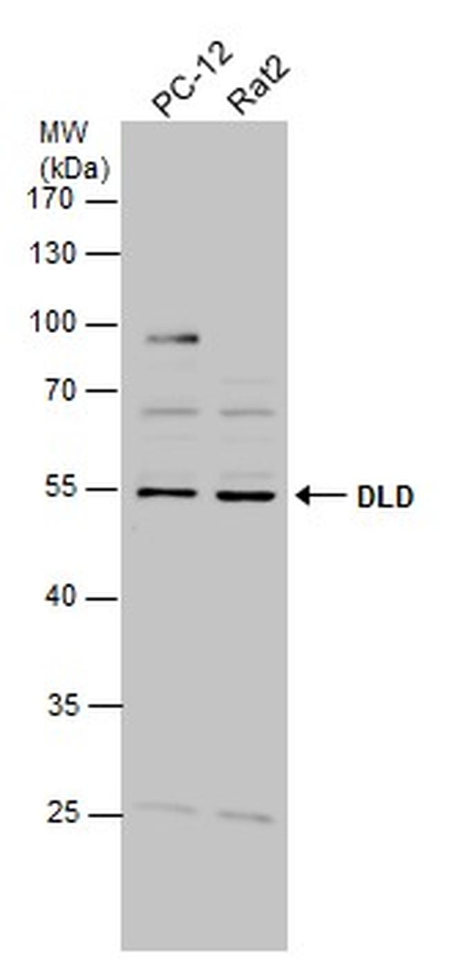 DLD Antibody in Western Blot (WB)