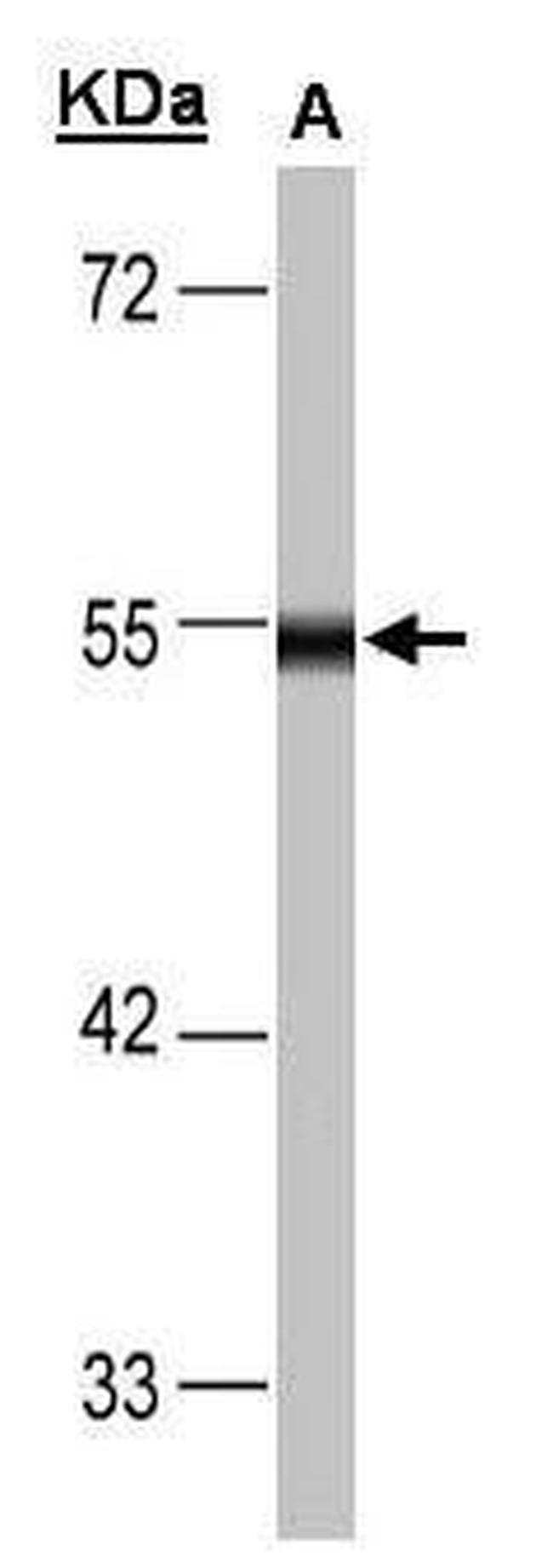 DLD Antibody in Western Blot (WB)