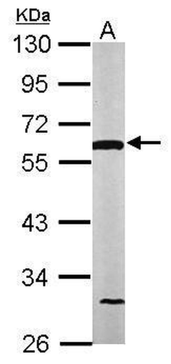 DLD Antibody in Western Blot (WB)