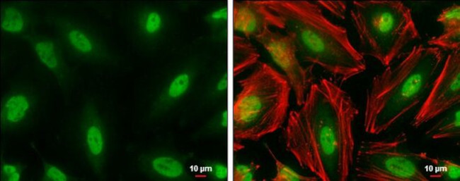 CBP Antibody in Immunocytochemistry (ICC/IF)