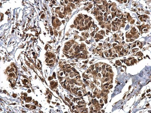 CBP Antibody in Immunohistochemistry (Paraffin) (IHC (P))