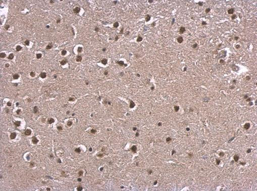 CBP Antibody in Immunohistochemistry (Paraffin) (IHC (P))