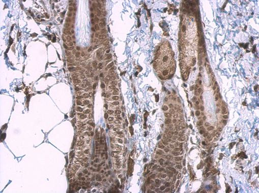 CBP Antibody in Immunohistochemistry (Paraffin) (IHC (P))