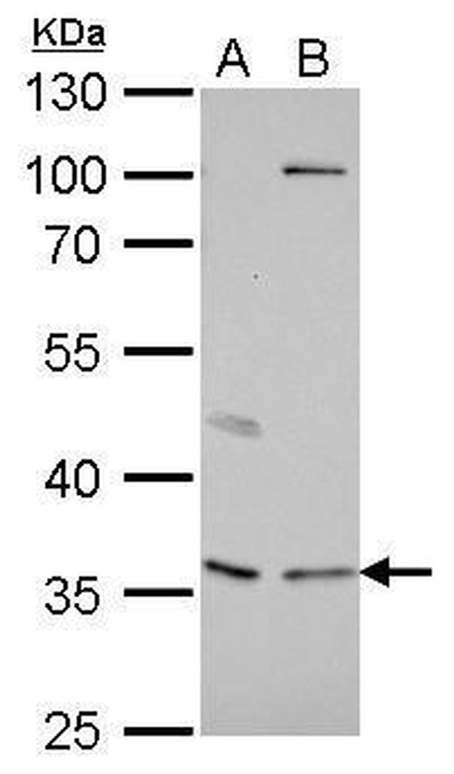 Decorin Antibody in Western Blot (WB)