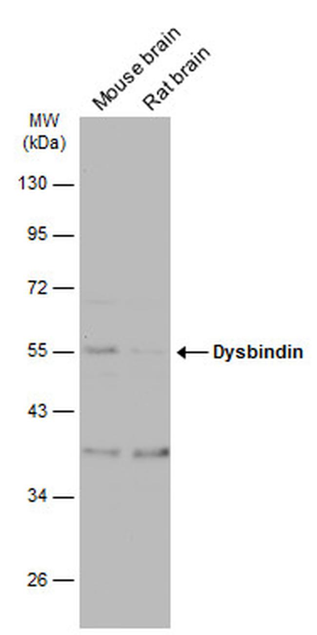 DTNBP1 Antibody in Western Blot (WB)