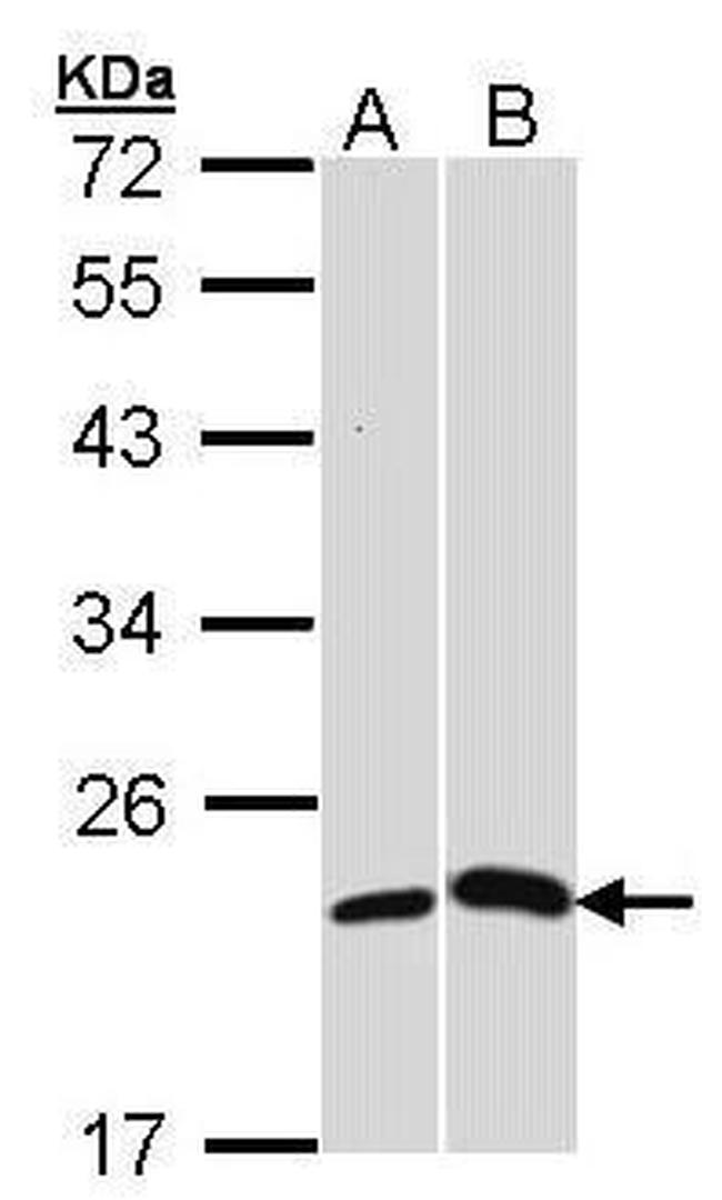 CRP Antibody in Western Blot (WB)