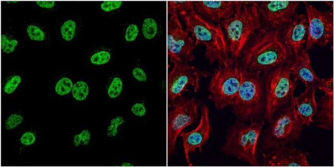 HMGB1 Antibody in Immunocytochemistry (ICC/IF)