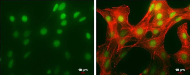 HMGB1 Antibody in Immunocytochemistry (ICC/IF)