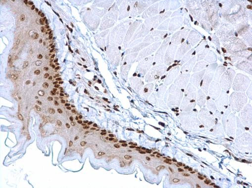 HMGB1 Antibody in Immunohistochemistry (Paraffin) (IHC (P))