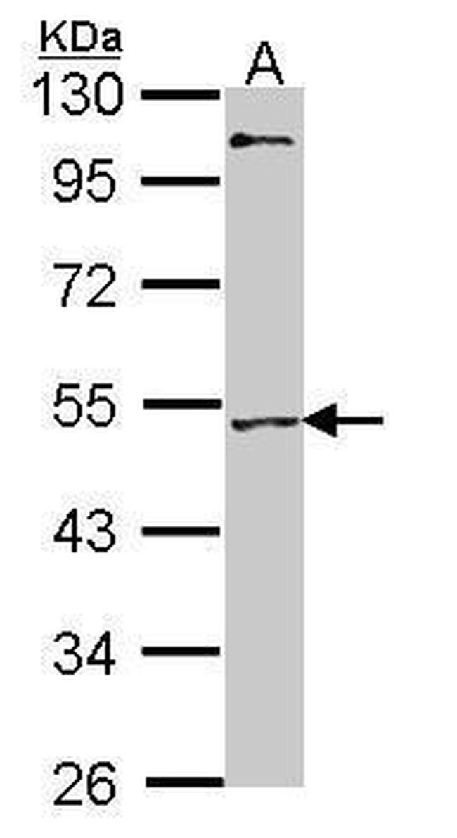 MEF2A Antibody in Western Blot (WB)