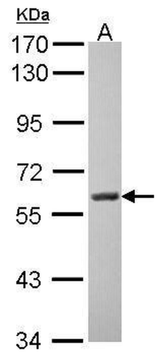 MAOA Antibody in Western Blot (WB)