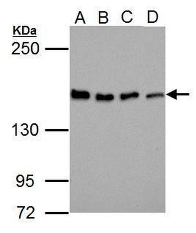 Blooms Syndrome Antibody in Western Blot (WB)