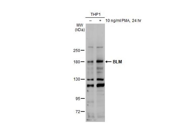 Blooms Syndrome Antibody in Western Blot (WB)