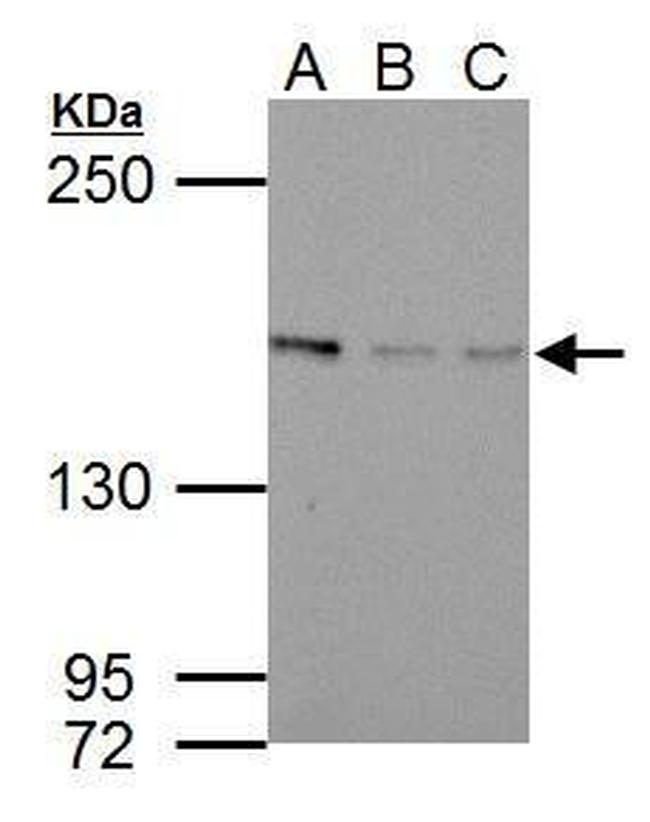 Blooms Syndrome Antibody in Western Blot (WB)