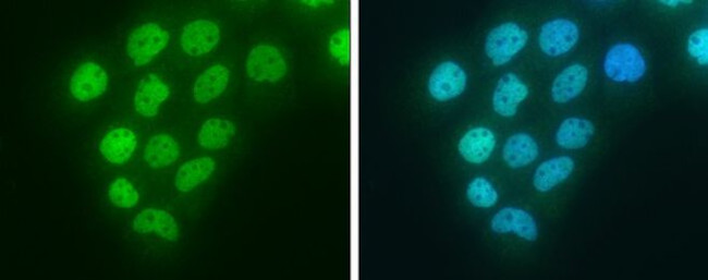 Blooms Syndrome Antibody in Immunocytochemistry (ICC/IF)