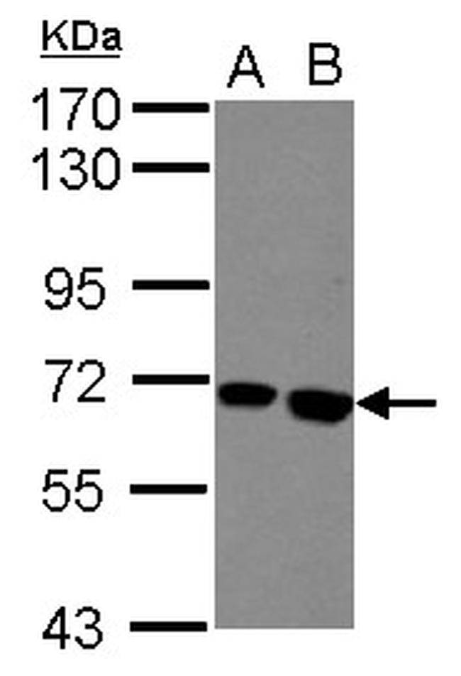 Butyrylcholinesterase Antibody in Western Blot (WB)