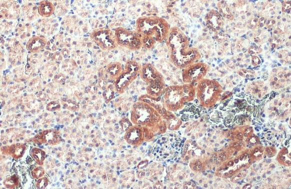 Caspase 1 Antibody in Immunohistochemistry (Paraffin) (IHC (P))