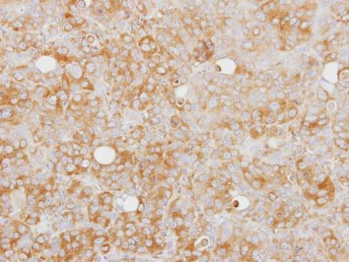 Caspase 1 Antibody in Immunohistochemistry (Paraffin) (IHC (P))